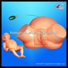 ISO Advanced Difficult Labor Model, Childbirth Simulator,difficult labor simulator